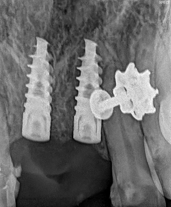 DENTAL DISTRICT Bhoopasandra Bangalore