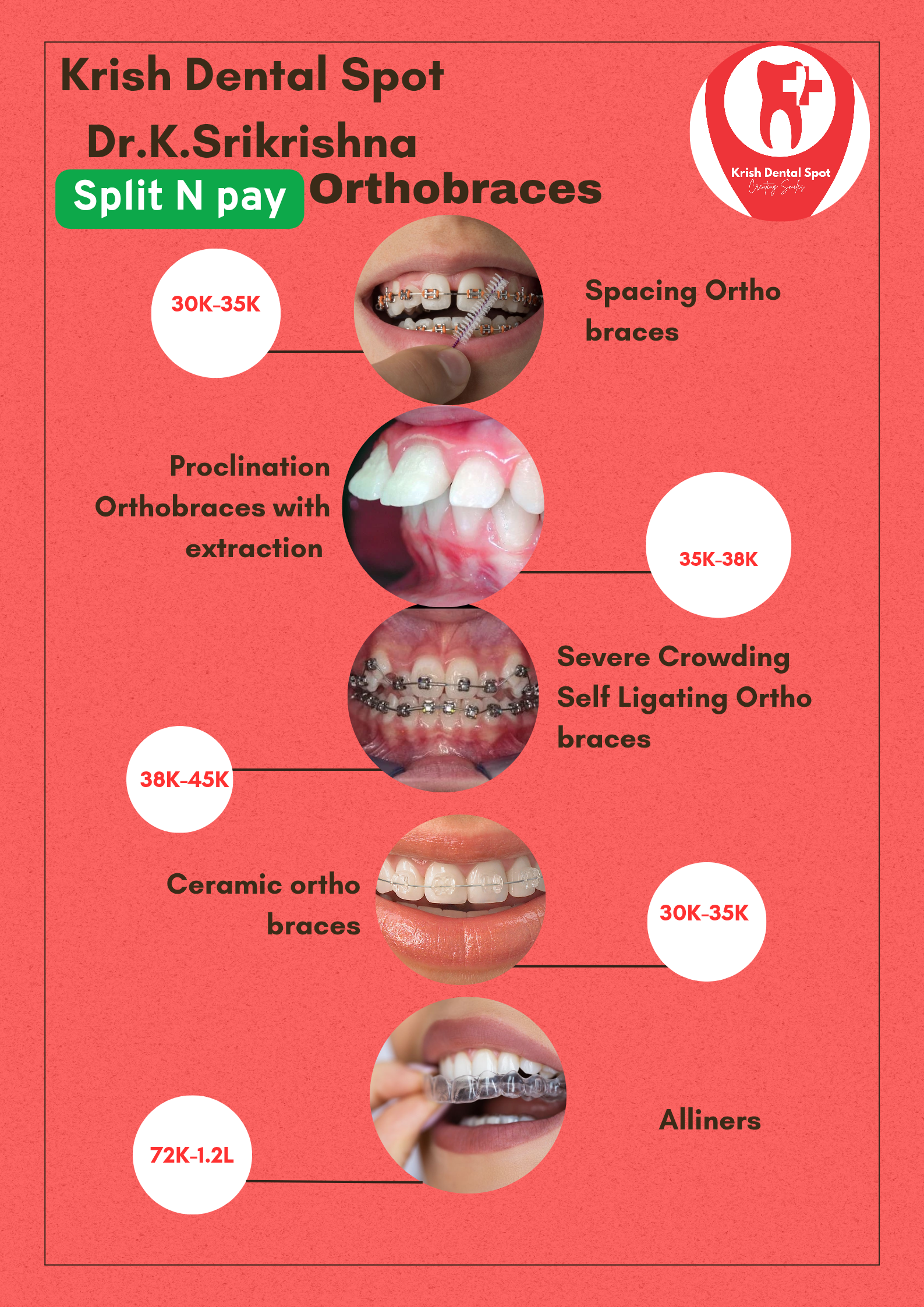 Krish Dental Spot Guduvanchery Chennai
