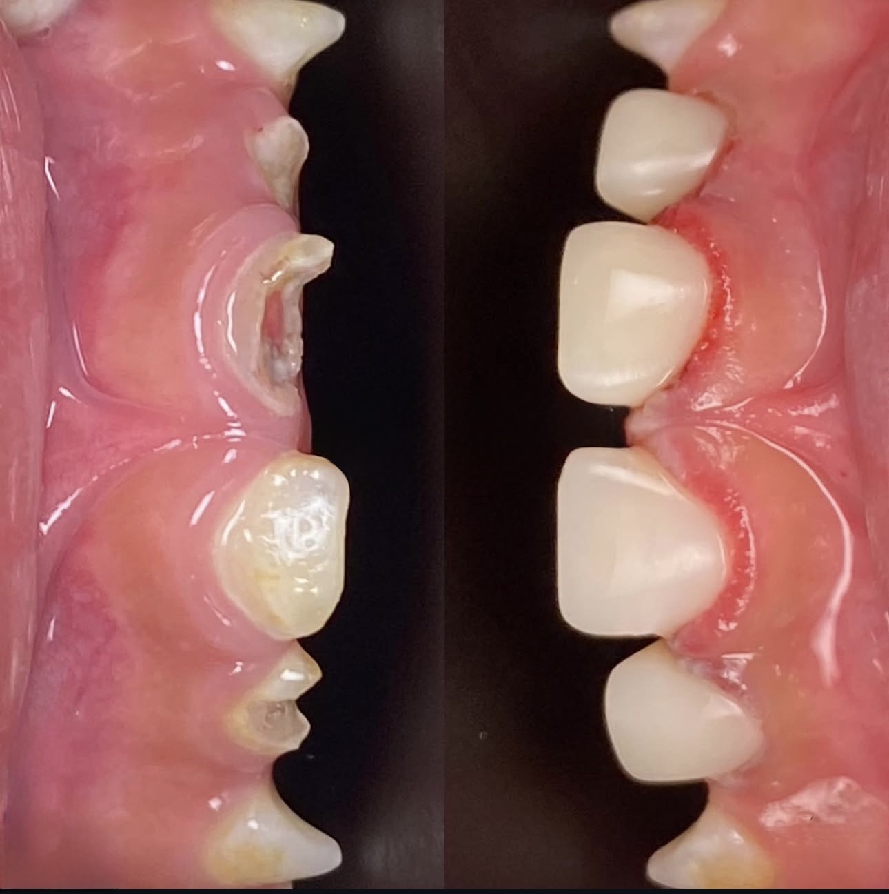 Dr. Rohini's Dental Square Kallepulli Palakkad