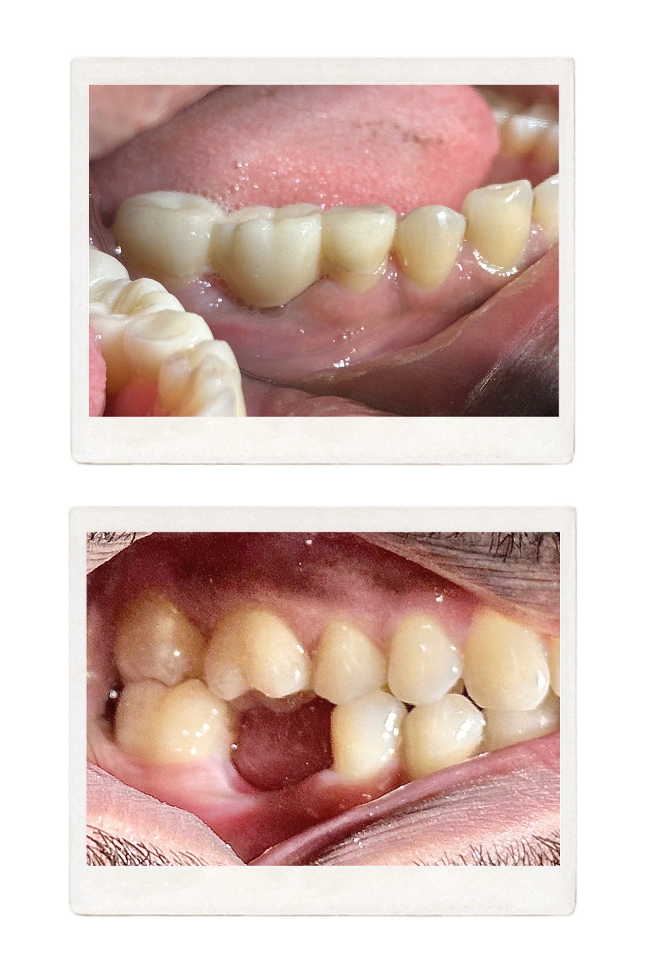 Maxwhite Dental Clinic Dilshad Garden Delhi