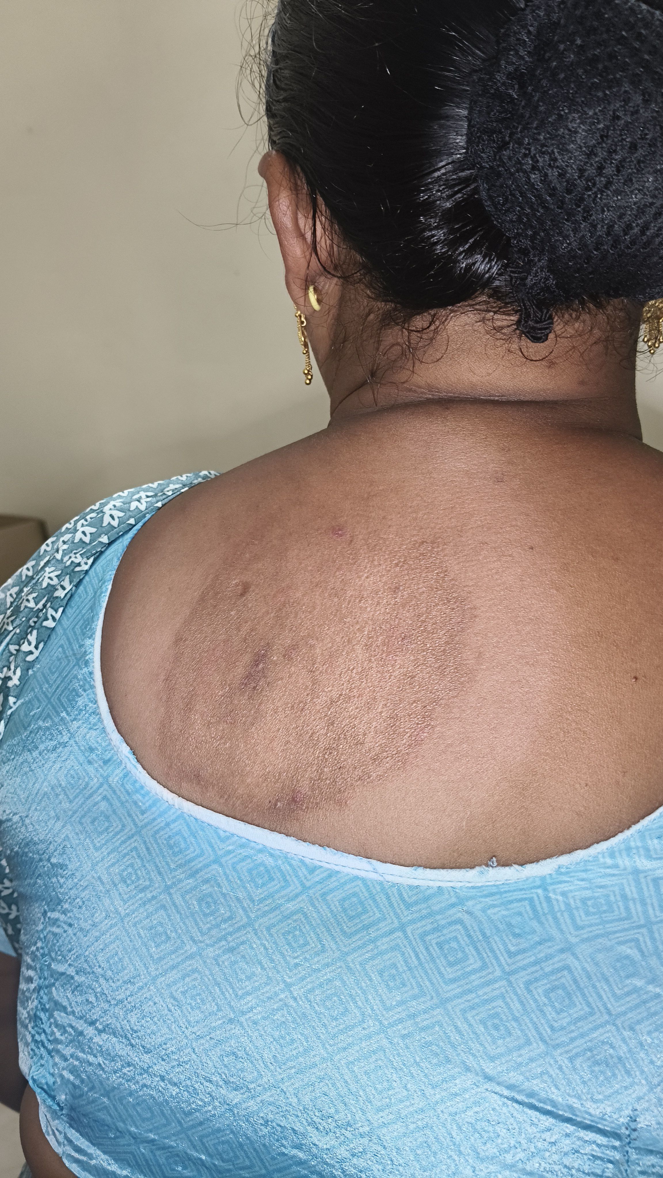 Lues Homoeopathy Clinic Kovvur West Godavari