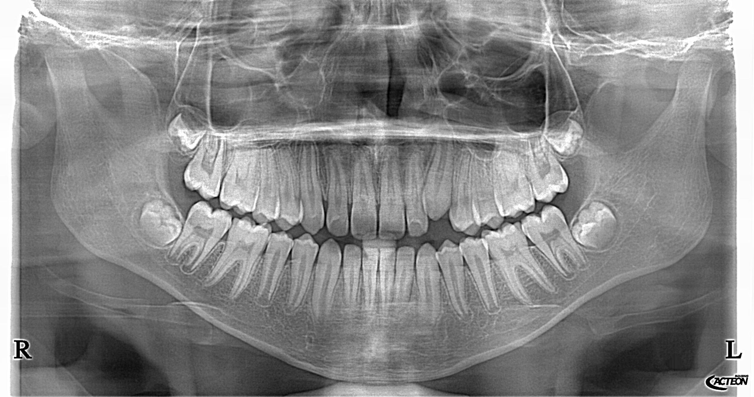 Durgha Dental Clinic Thiruvanmiyur Chennai