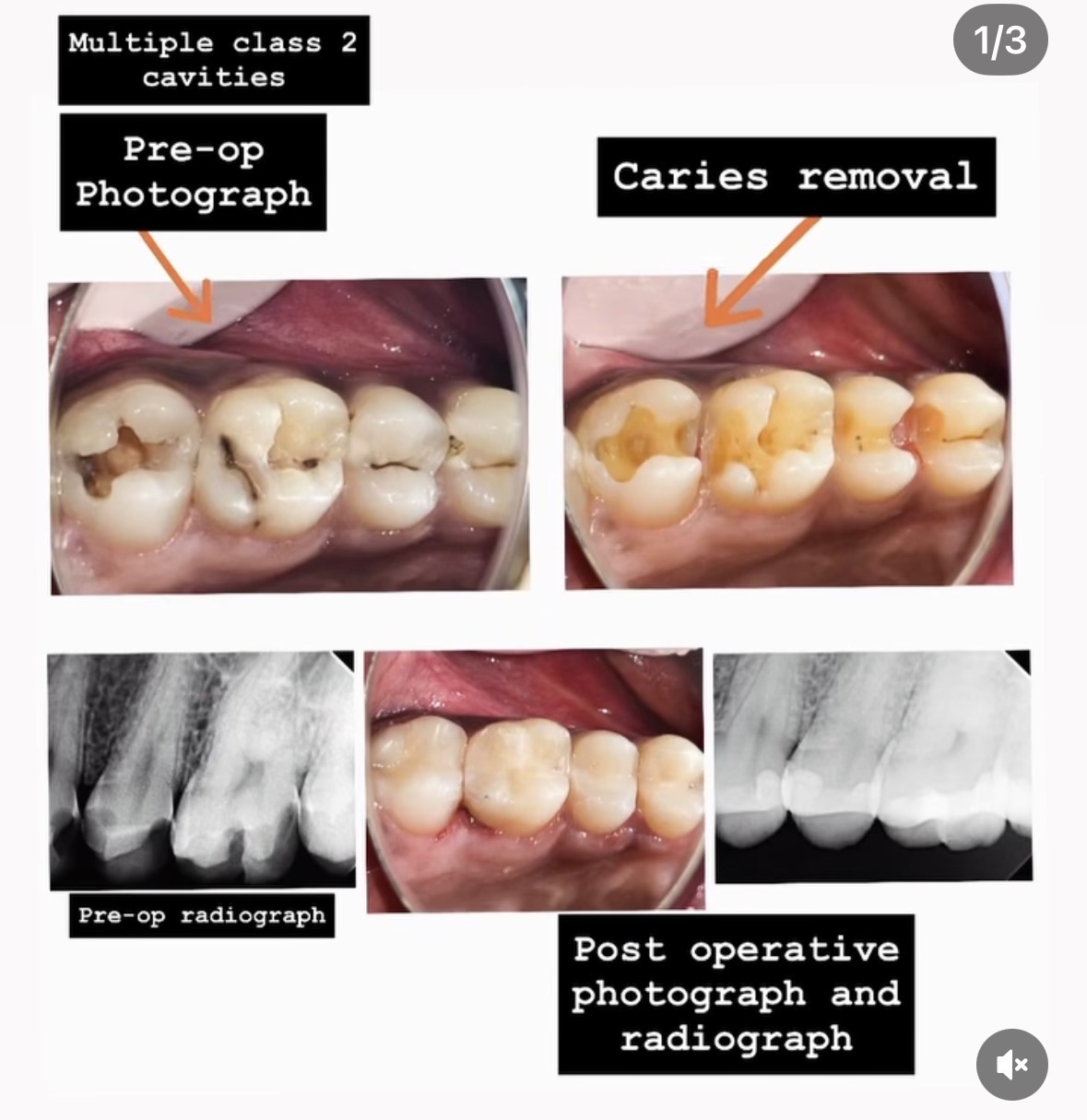 The Oral Edit -Advanced Dental clinic Viman Nagar Pune