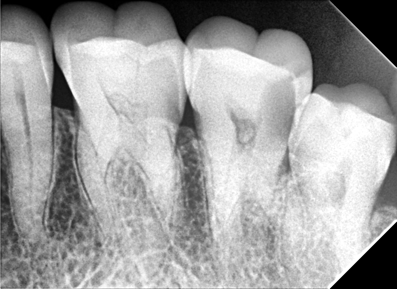 DR. BHUSHAN DENTAL Chhatarpur New Delhi
