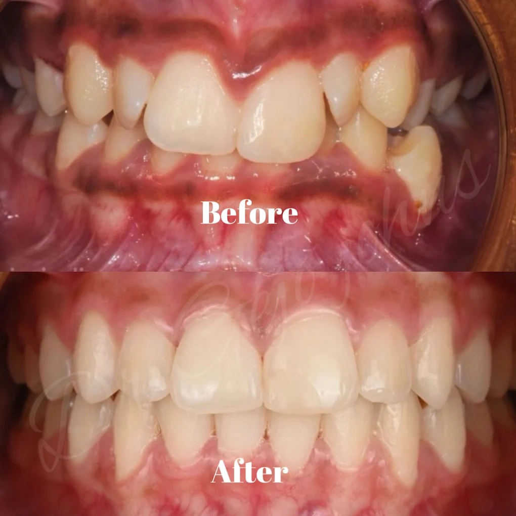 Lumiere Dental and Aesthetic Multispeciality Dental Clinic Vennala Ernakulam