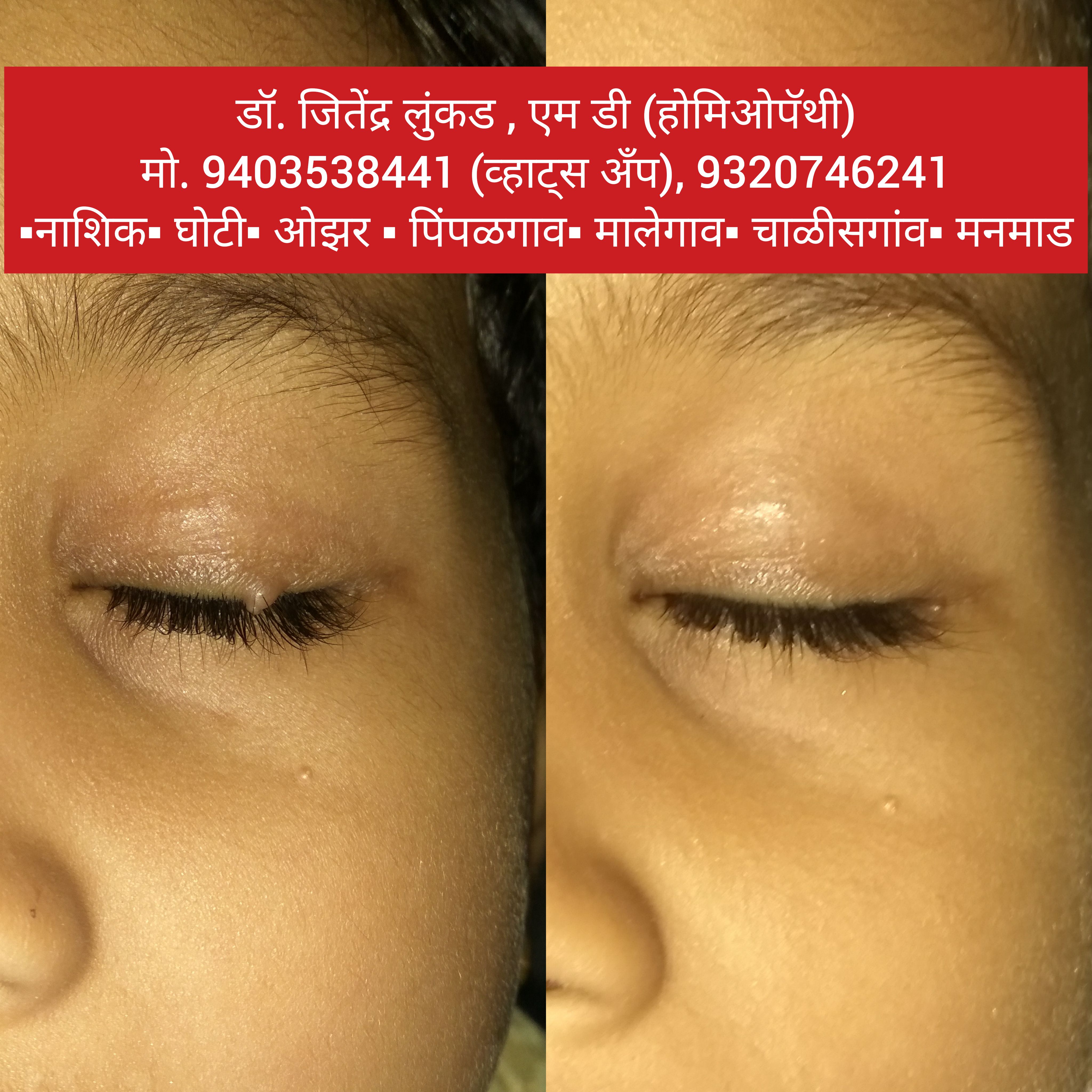 View All