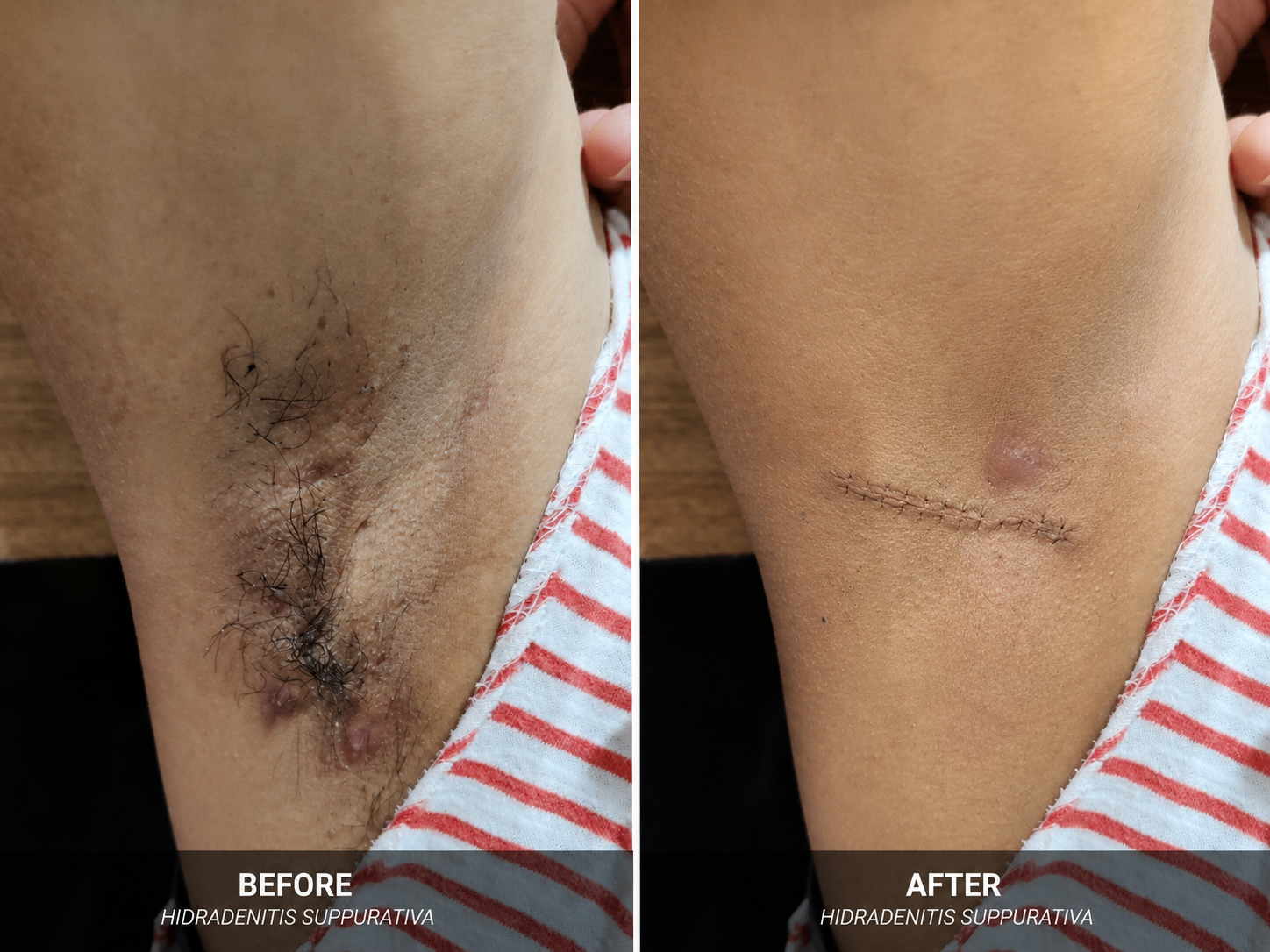 Surgeries & Treatments