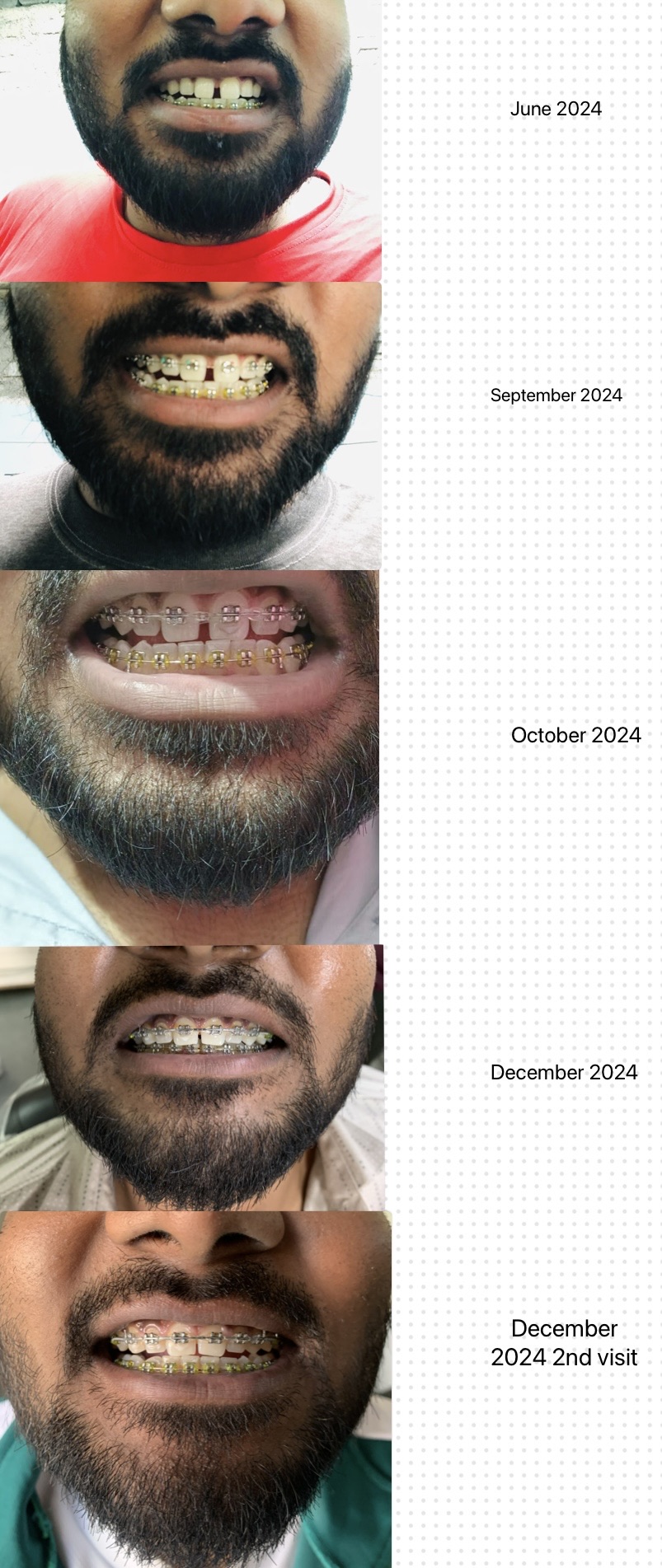 Surgeries & Treatments
