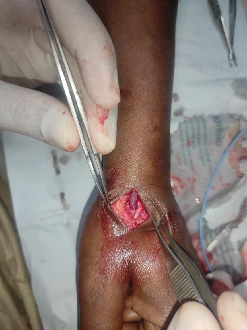Surgeries & Treatments