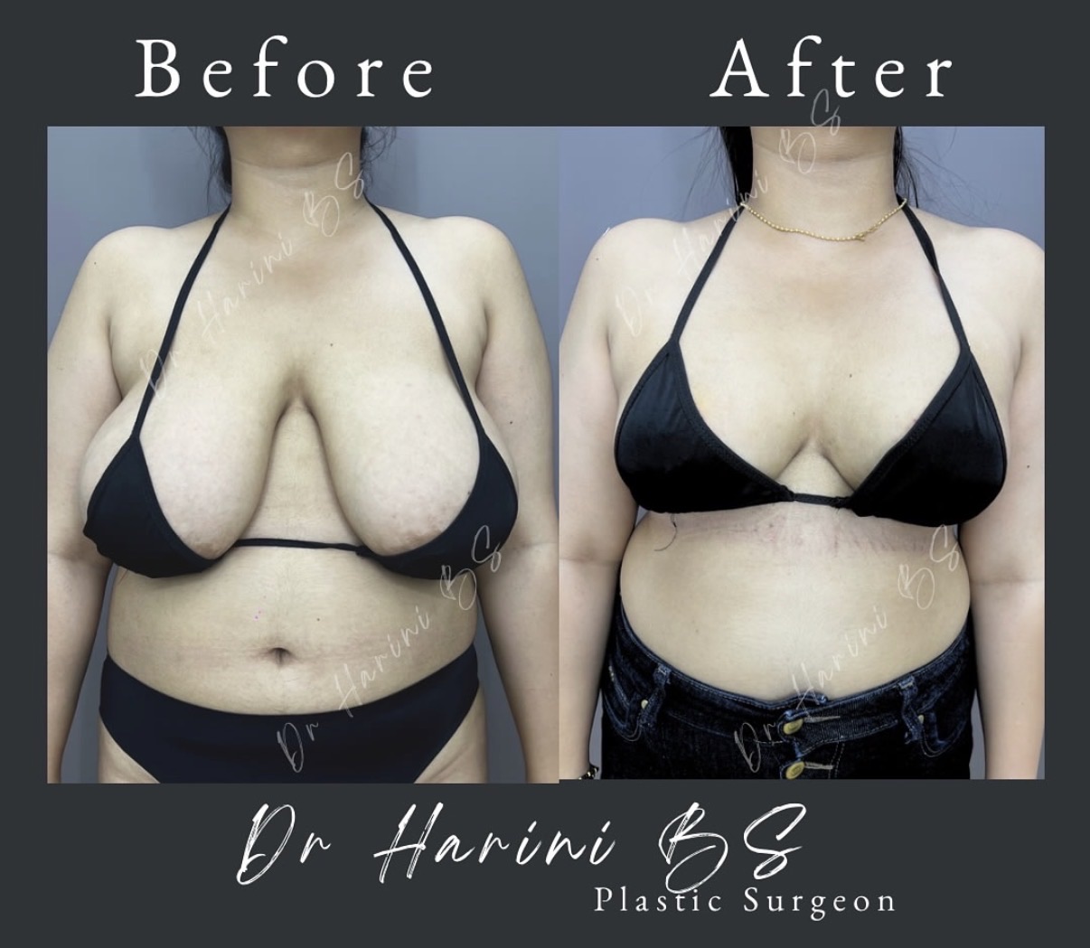 Surgeries & Treatments