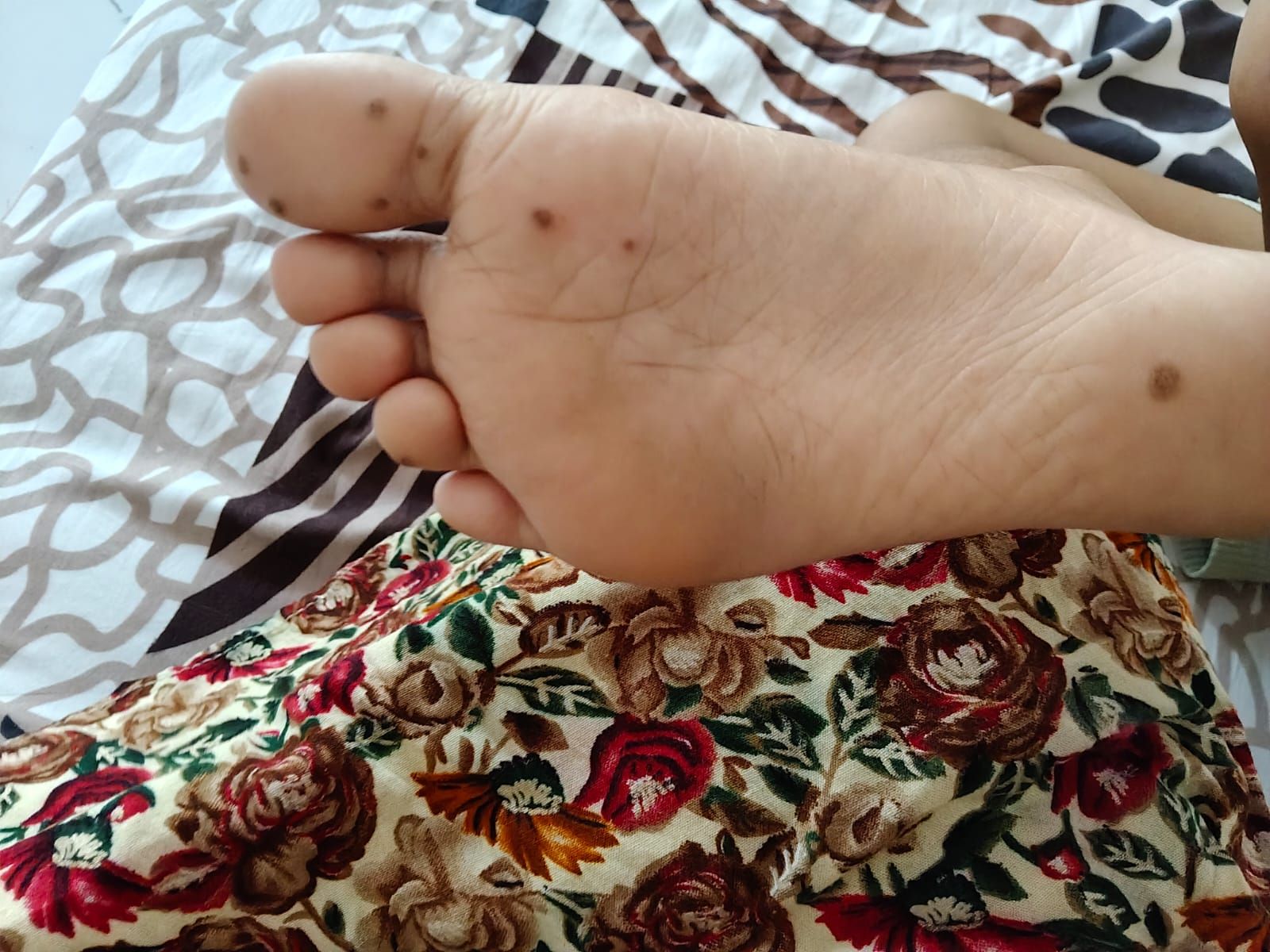 View All