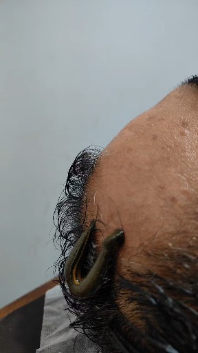 Surgeries & Treatments
