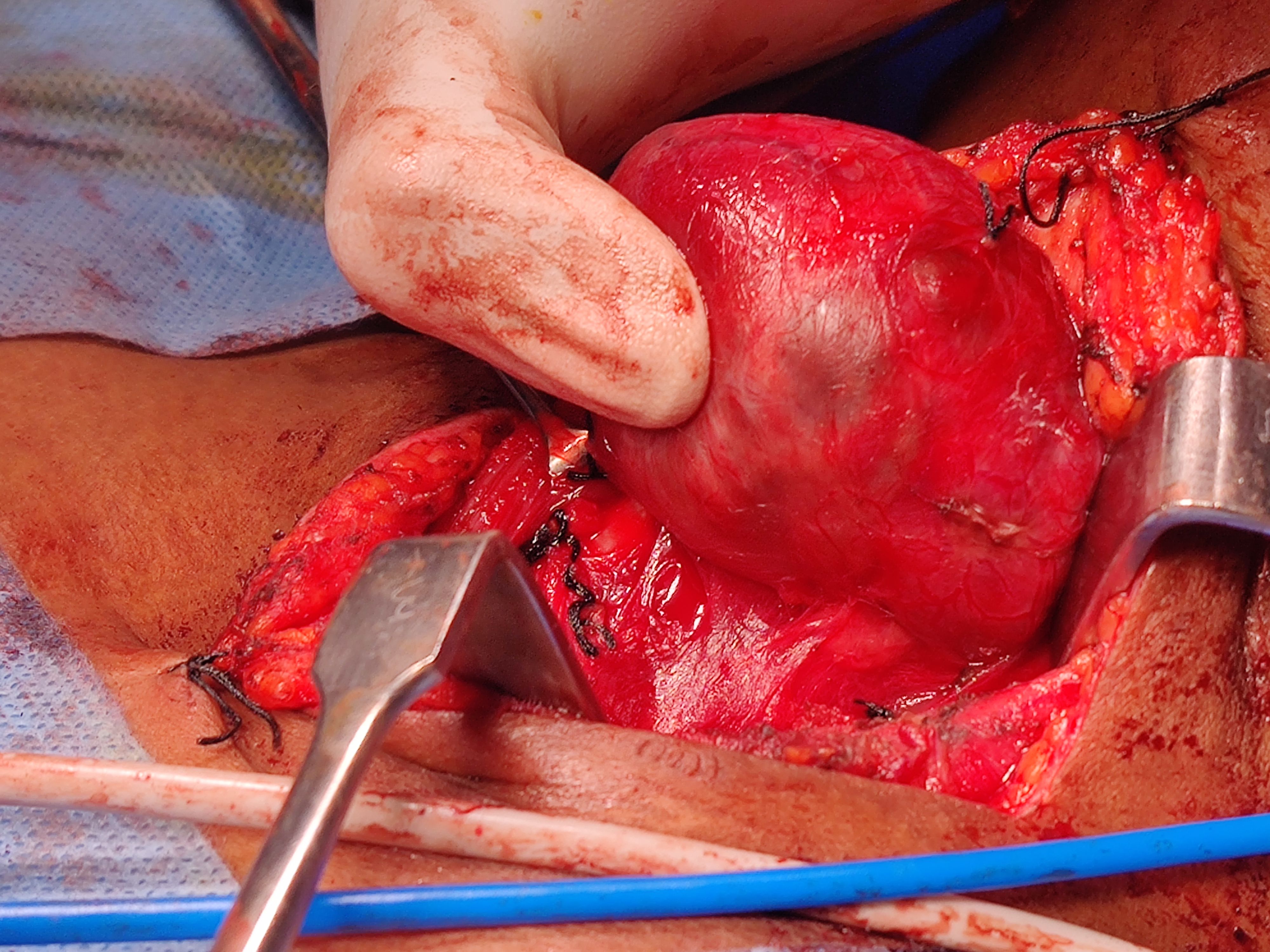 Surgeries & Treatments