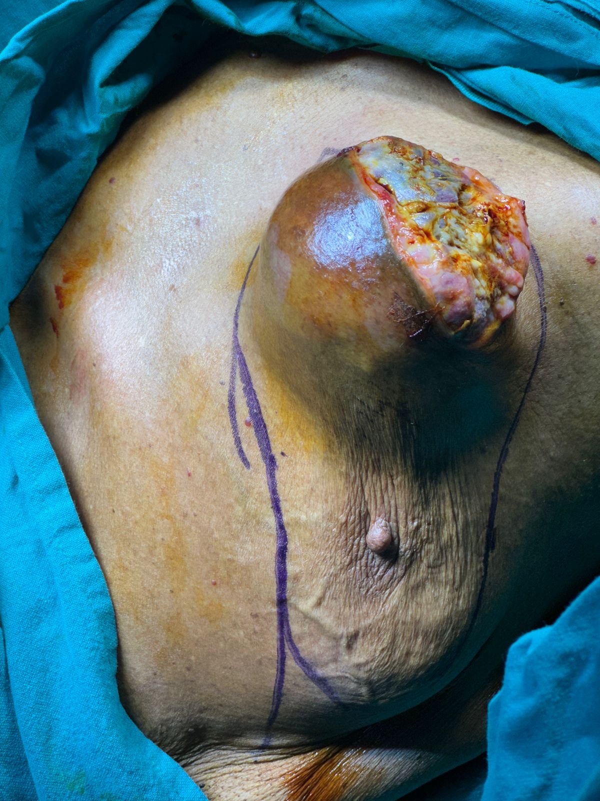 Surgeries & Treatments